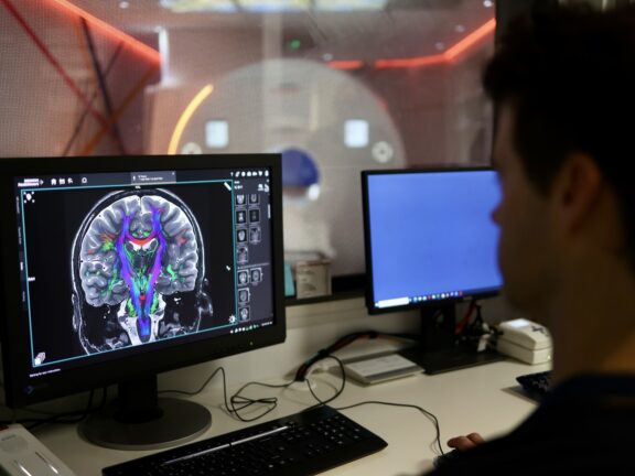 SAHMRI World Leading 3T Clinical MRI Goes Online In Adelaide