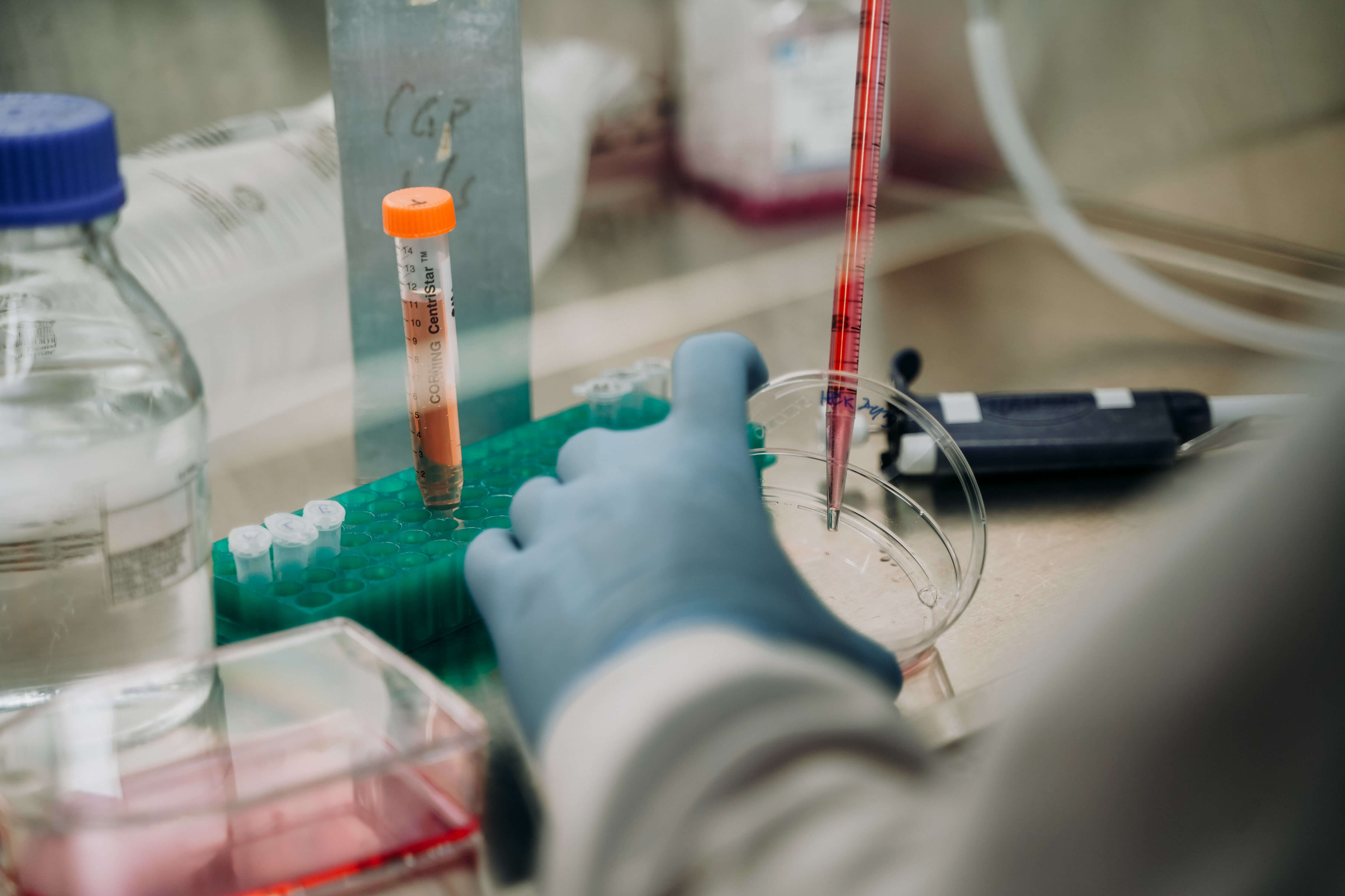 Lysosomal Health In Ageing