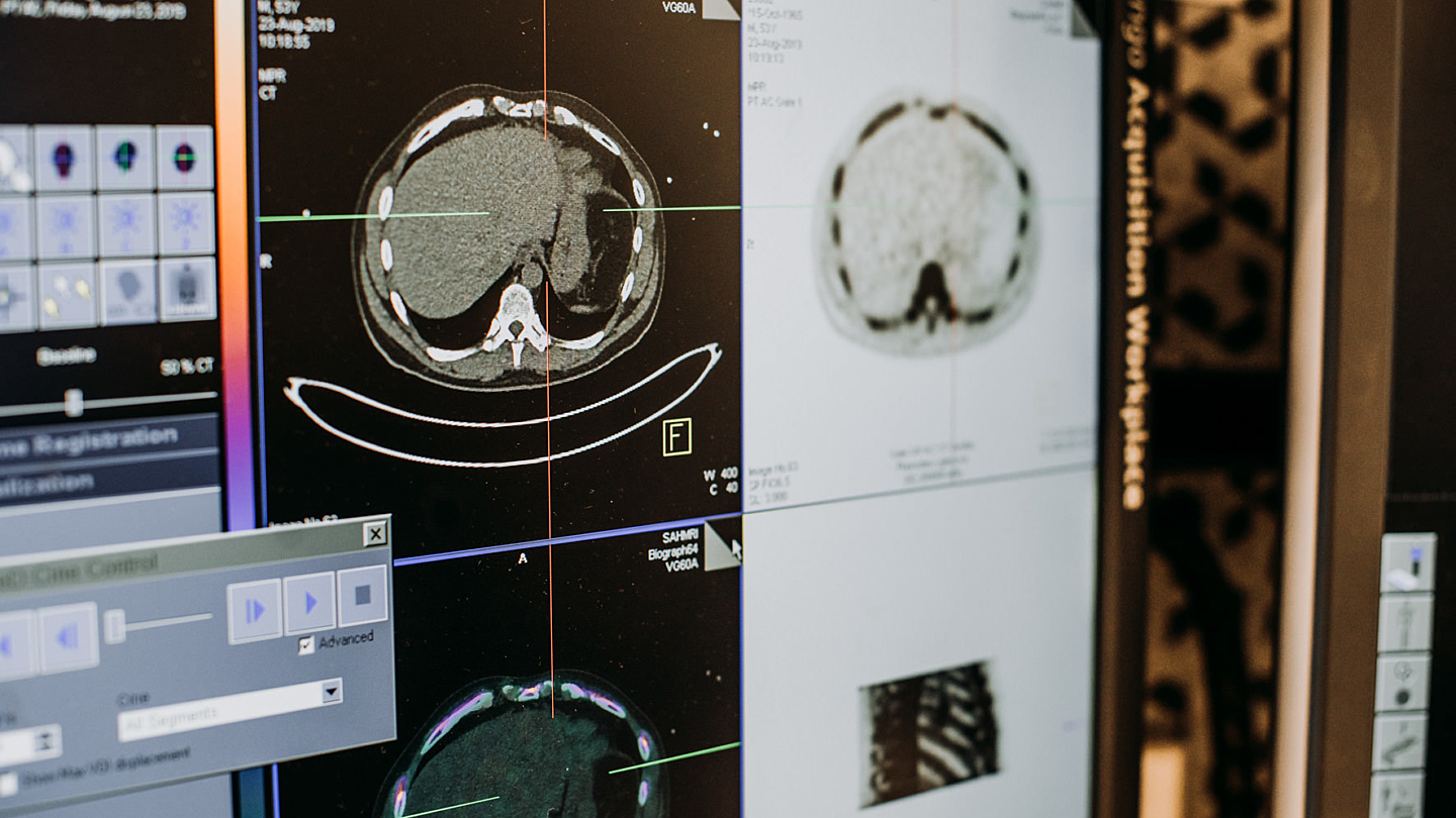 A game changer for imaging in South Australia