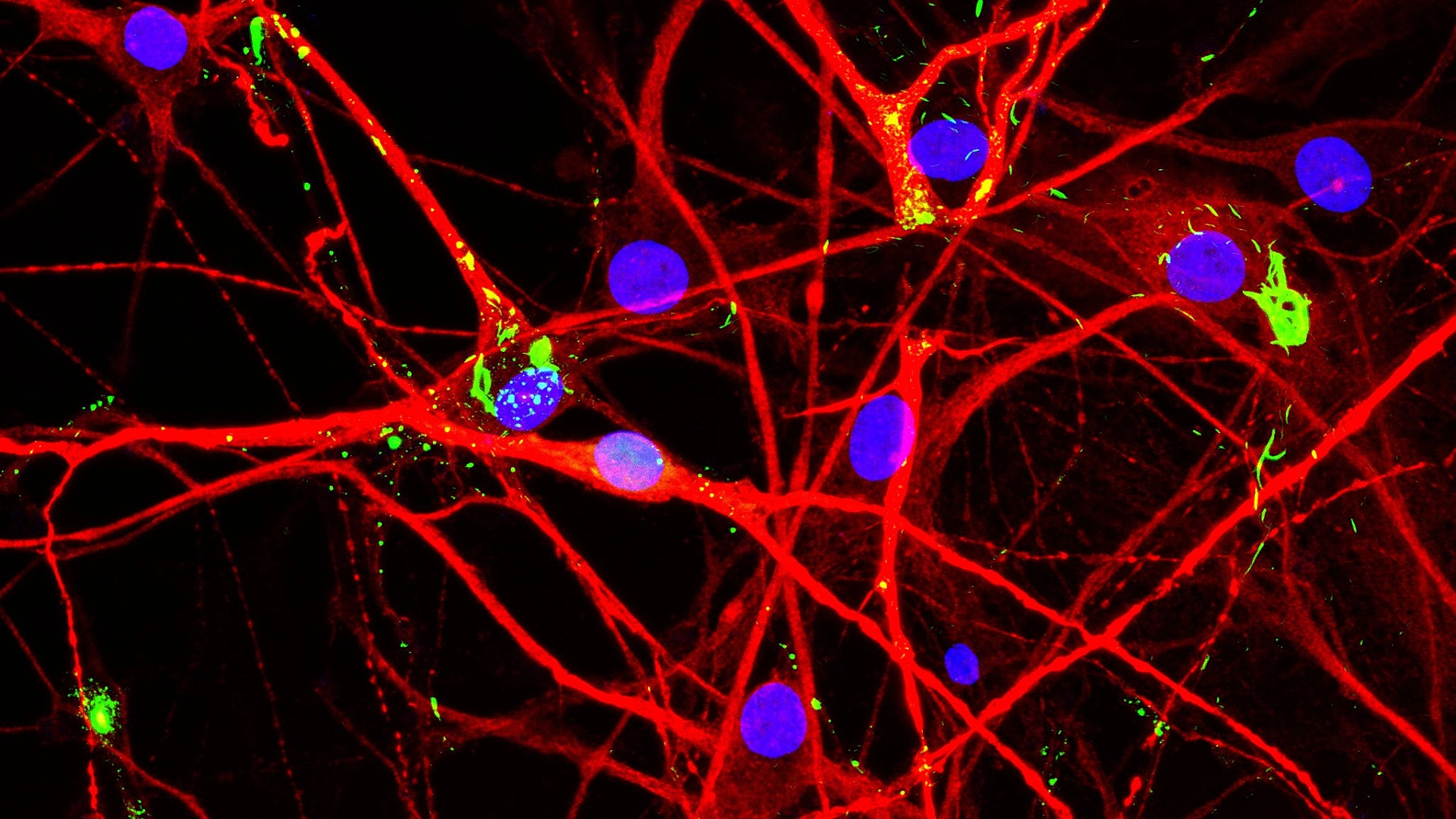 Demystifying the brain’s defence against dementia