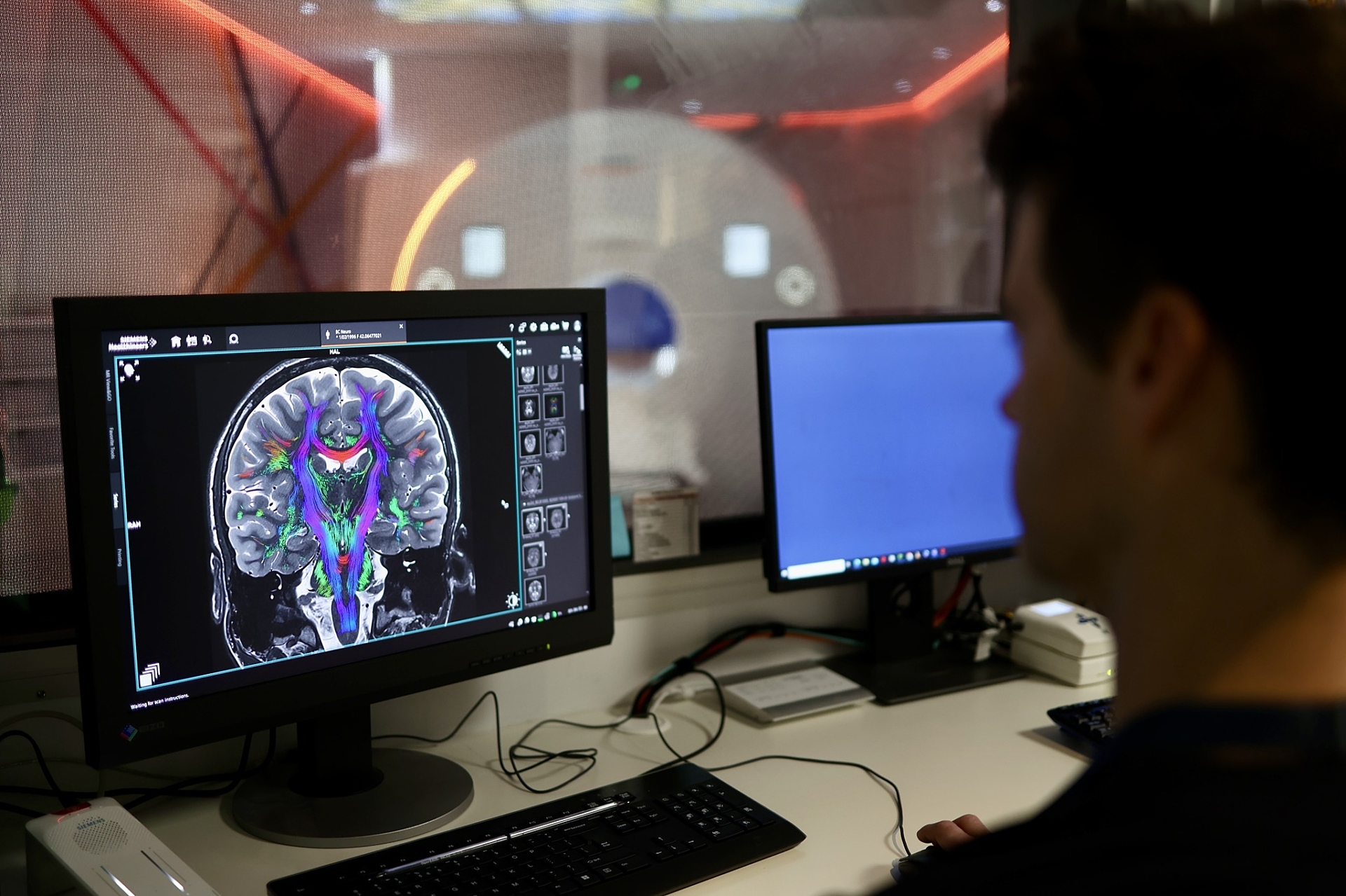 World-leading 3T clinical MRI goes online in Adelaide