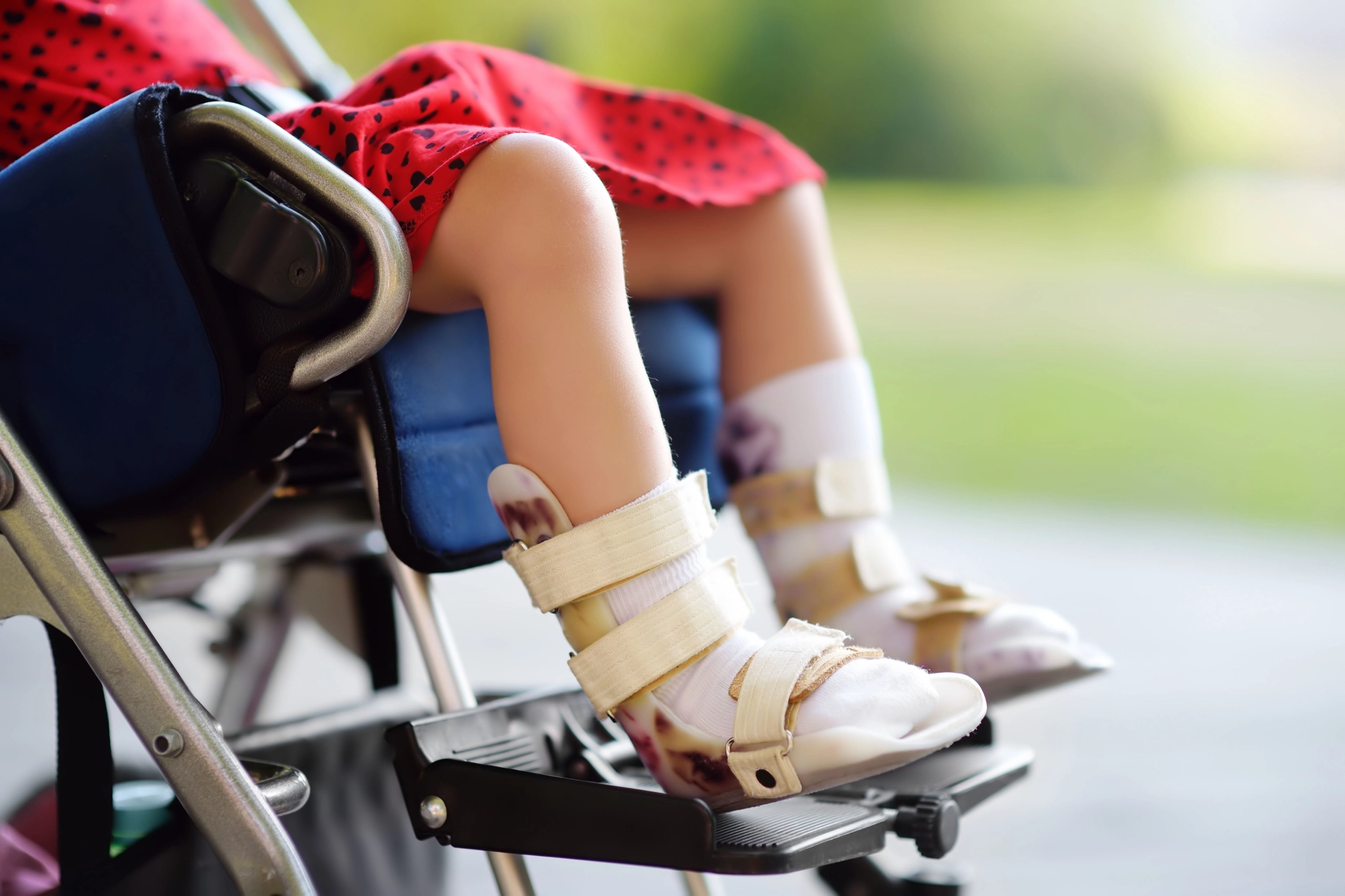 Program to reduce rates of cerebral palsy and save millions of dollars