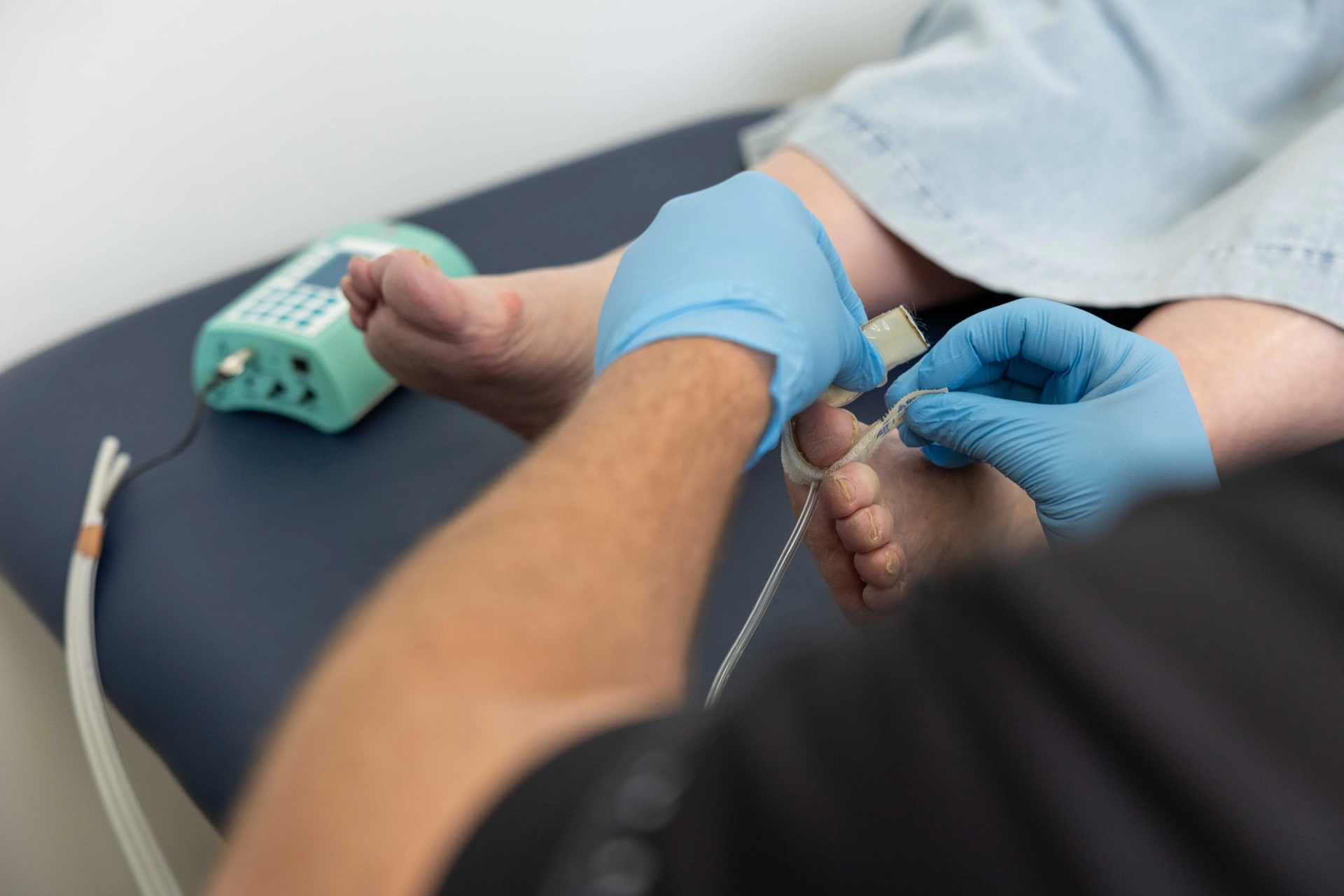 Study uncovers how good cholesterol helps heal diabetic wounds