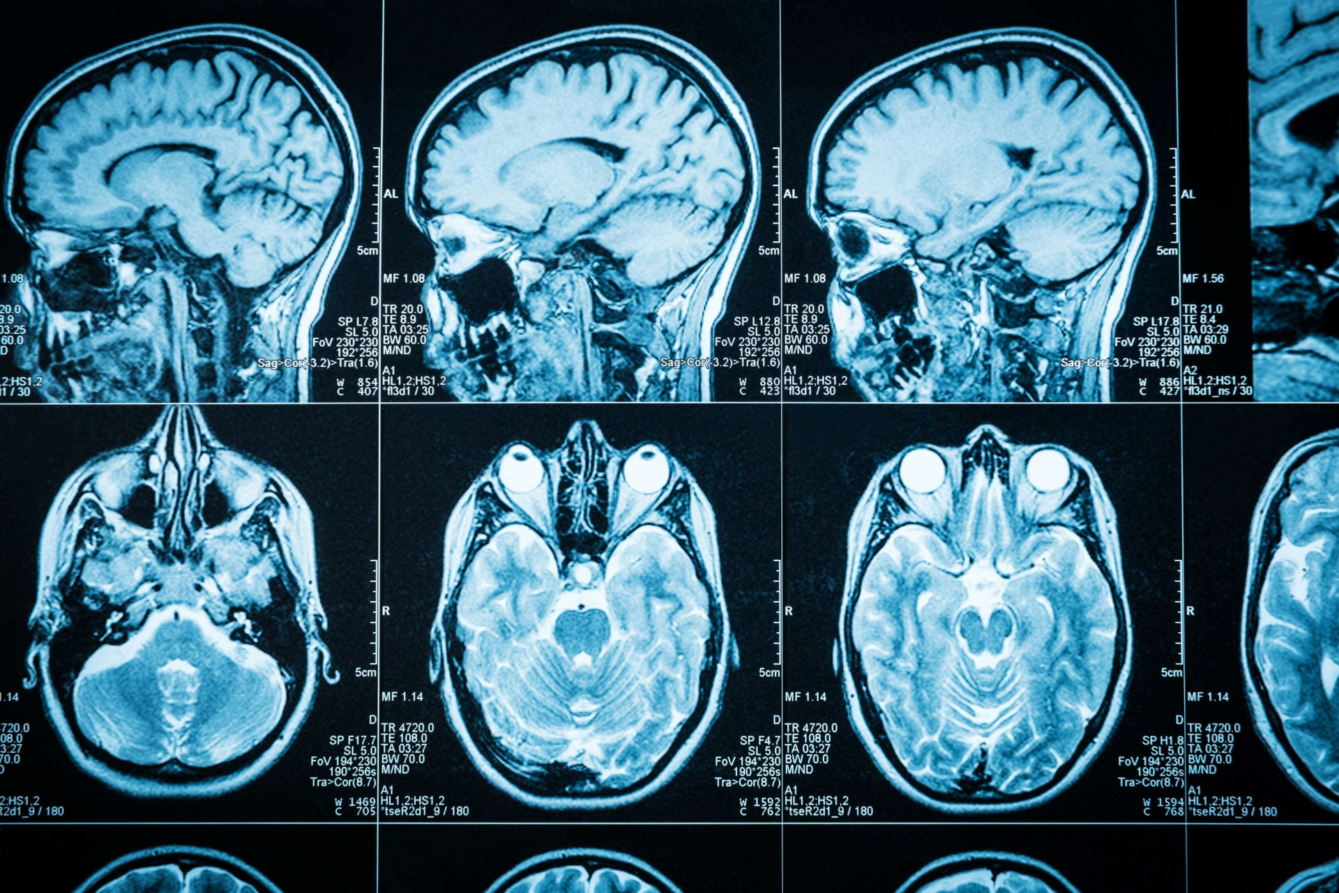 Establishing and supporting SA's paediatric central nervous system tumour biobank