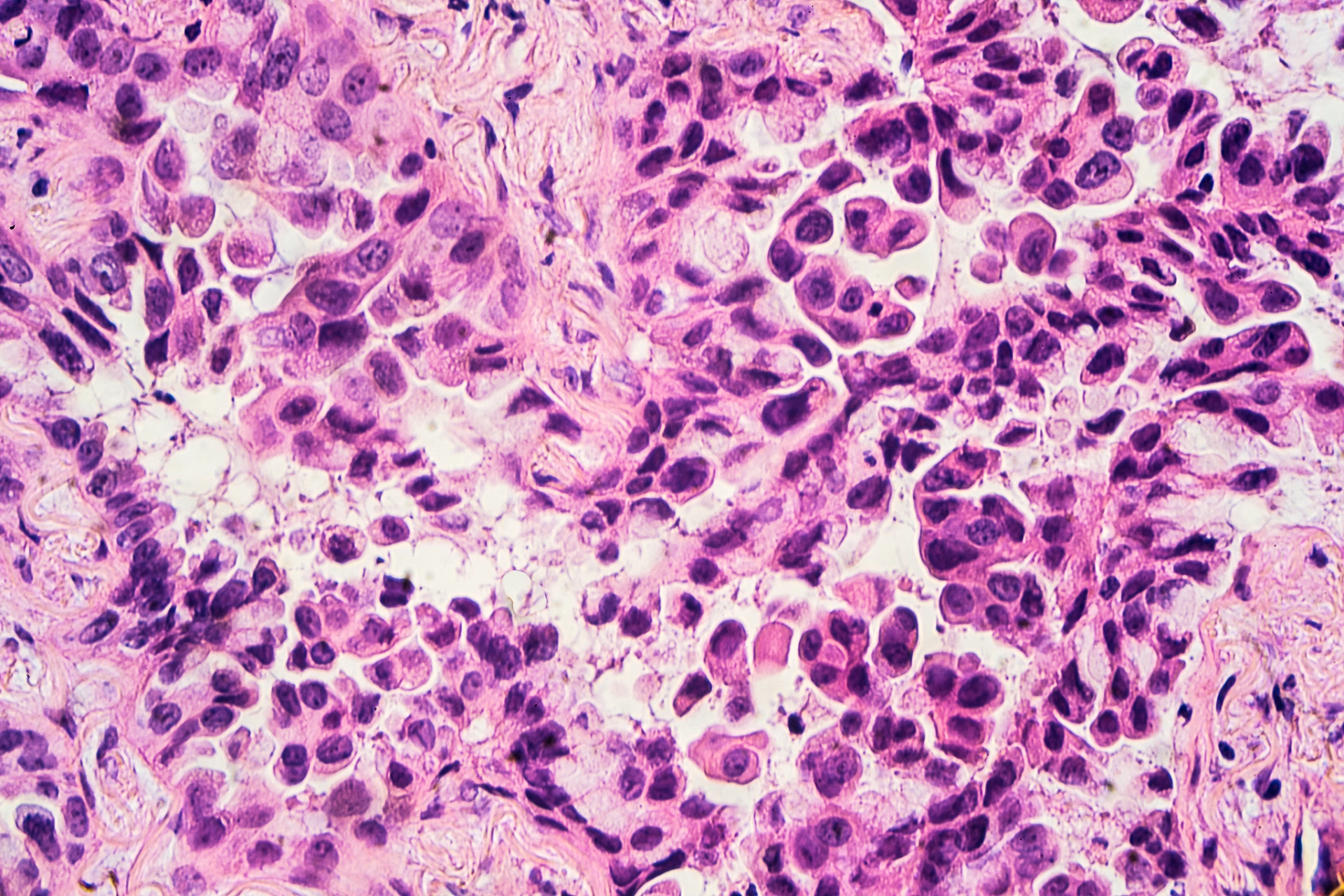 Review presents a new perspective on treatment response in CML