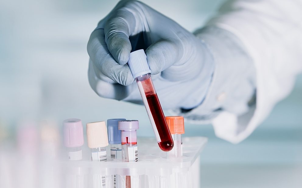 SAHMRI blood test for autophagy to guide healthy ageing