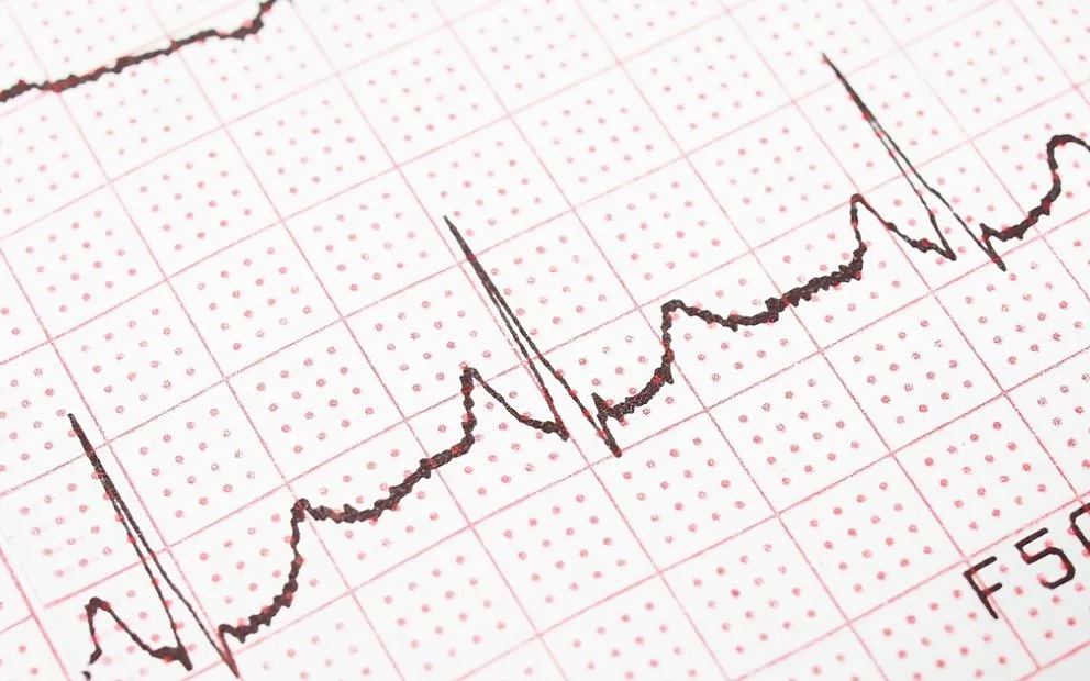 Cardiovascular specialists unite to tackle the war against heart disease