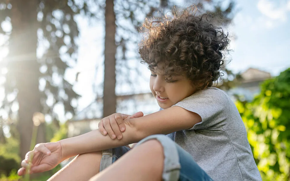 Molluscum Contagiosum Study