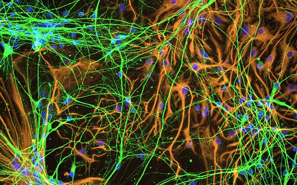 Brain Organoid Therapeutics (BOT)