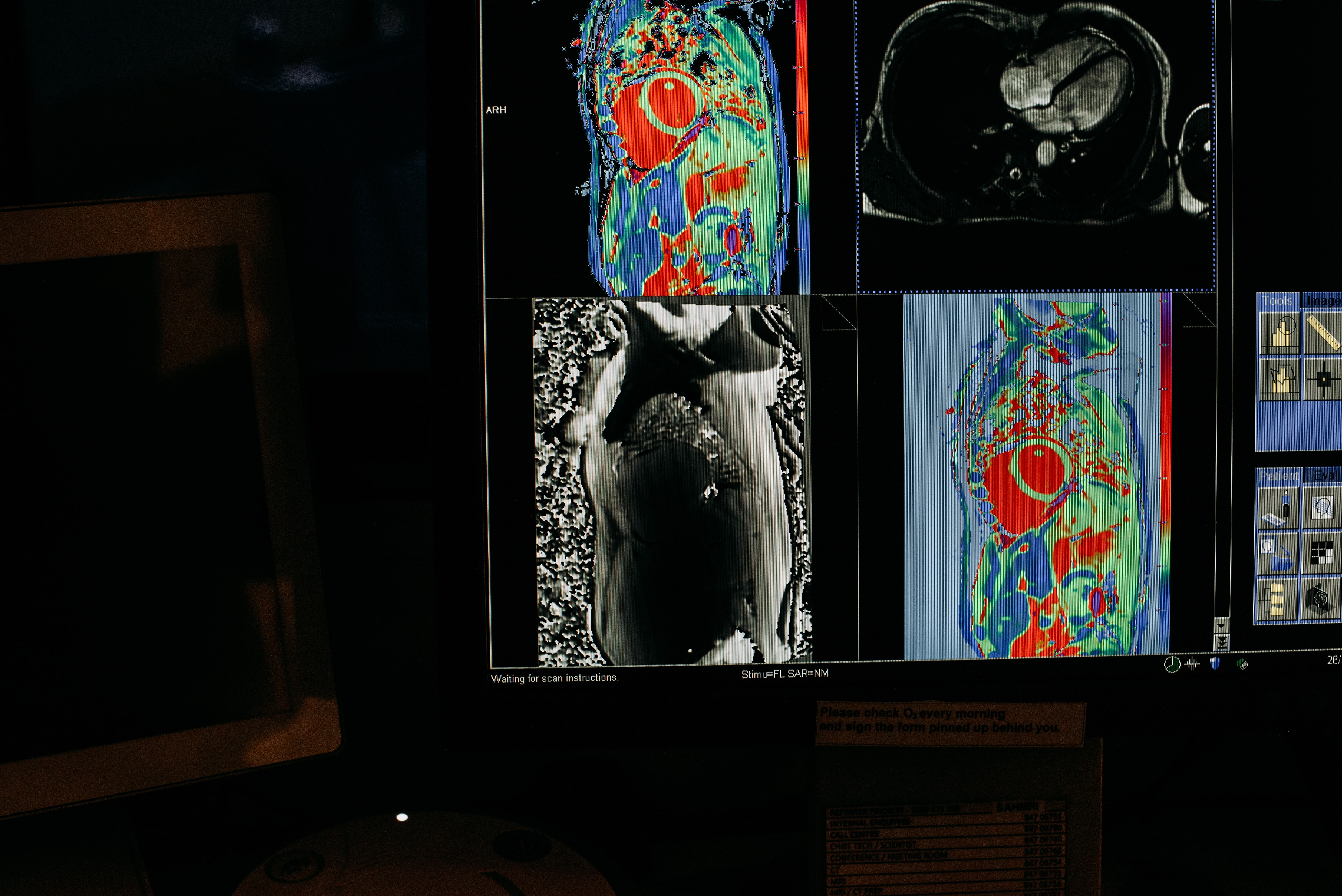 Cardiac Imaging Research Group